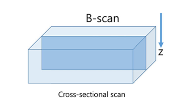 B-scan